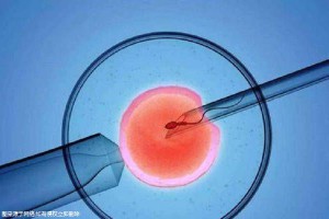 方鉴生殖医学中心
